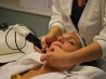 microabrasion-facial